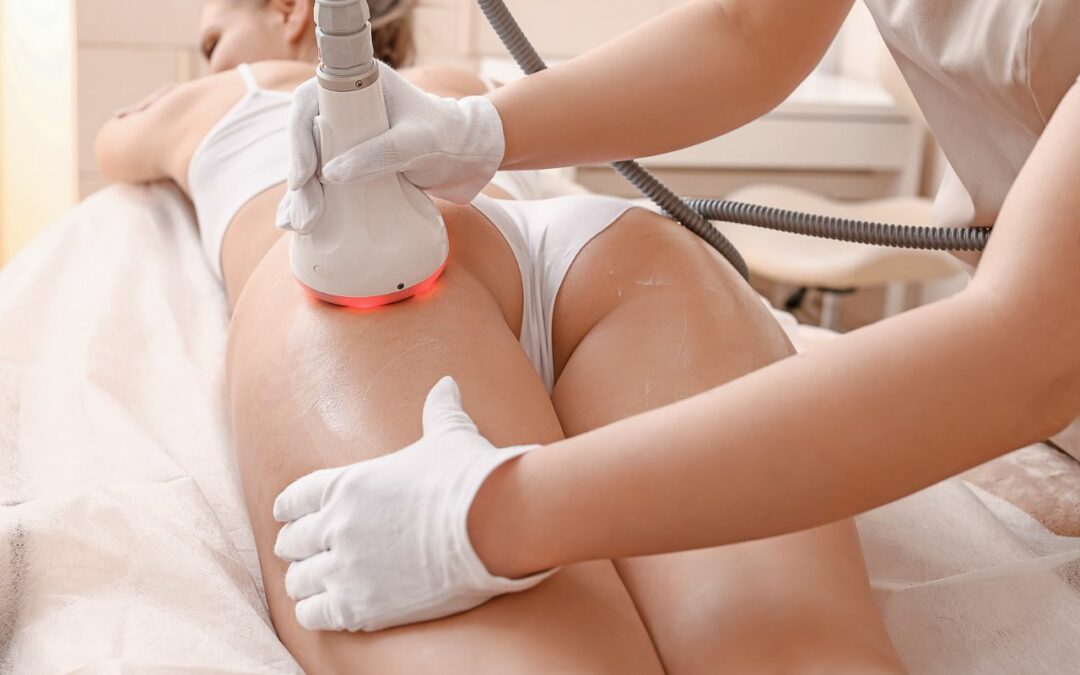 Cellulite: come ottenere i risultati desiderati  senza fatica