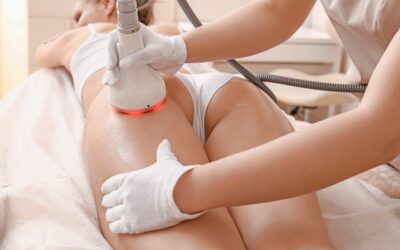 Cellulite: come ottenere i risultati desiderati  senza fatica